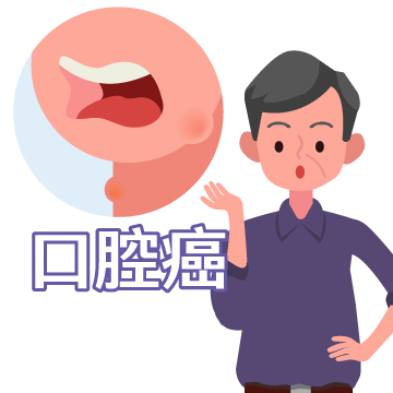 口腔癌